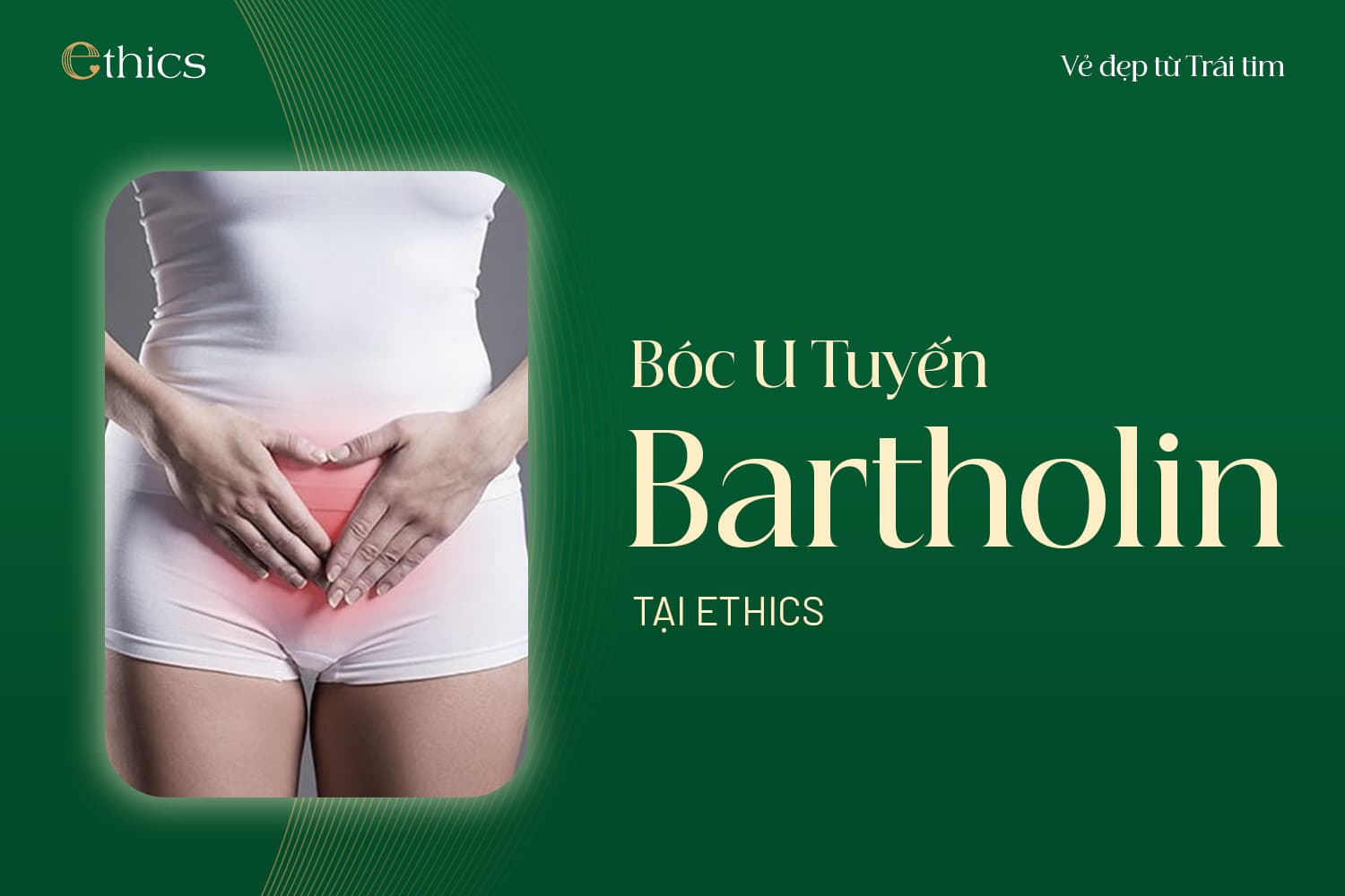 ການເອົາຖົງນ້ຳຕ່ອມ Bartholin ອອກ