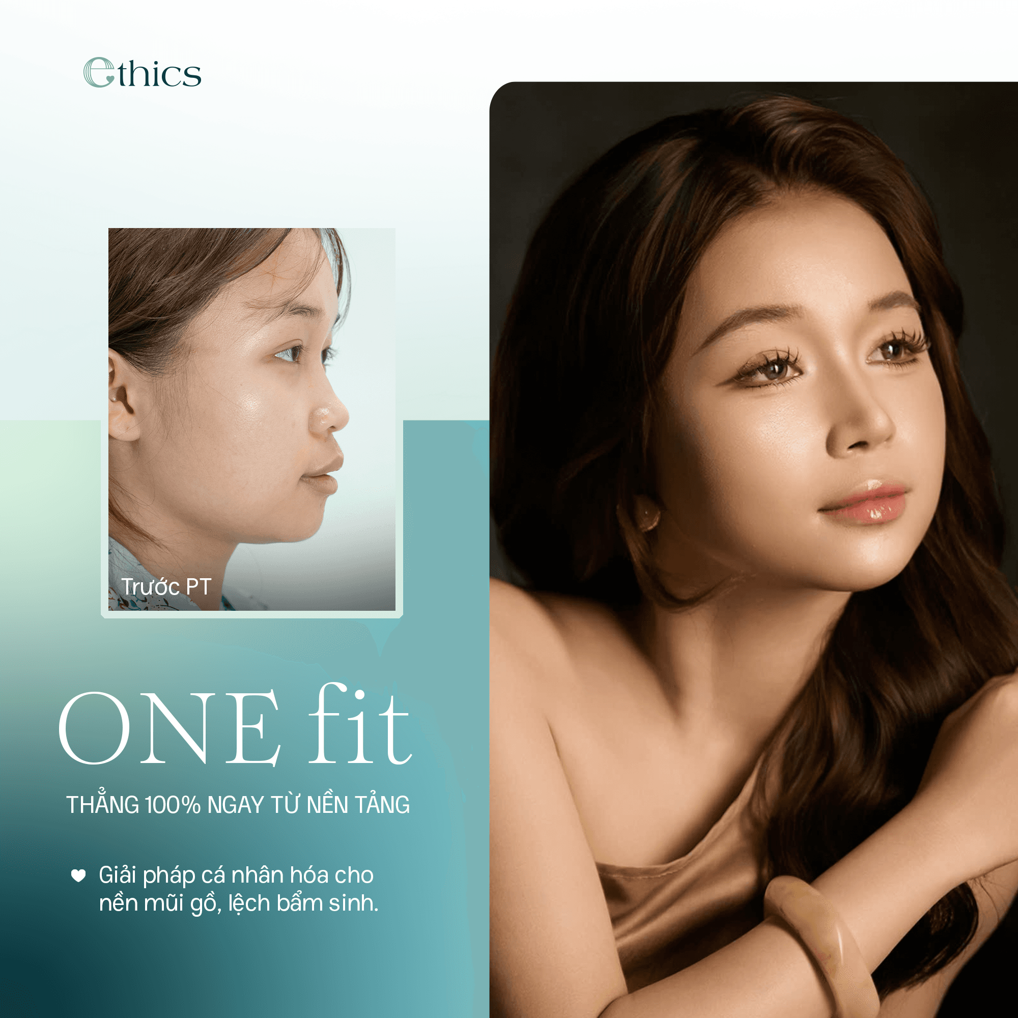 ການເສີມຄາງ OneFit