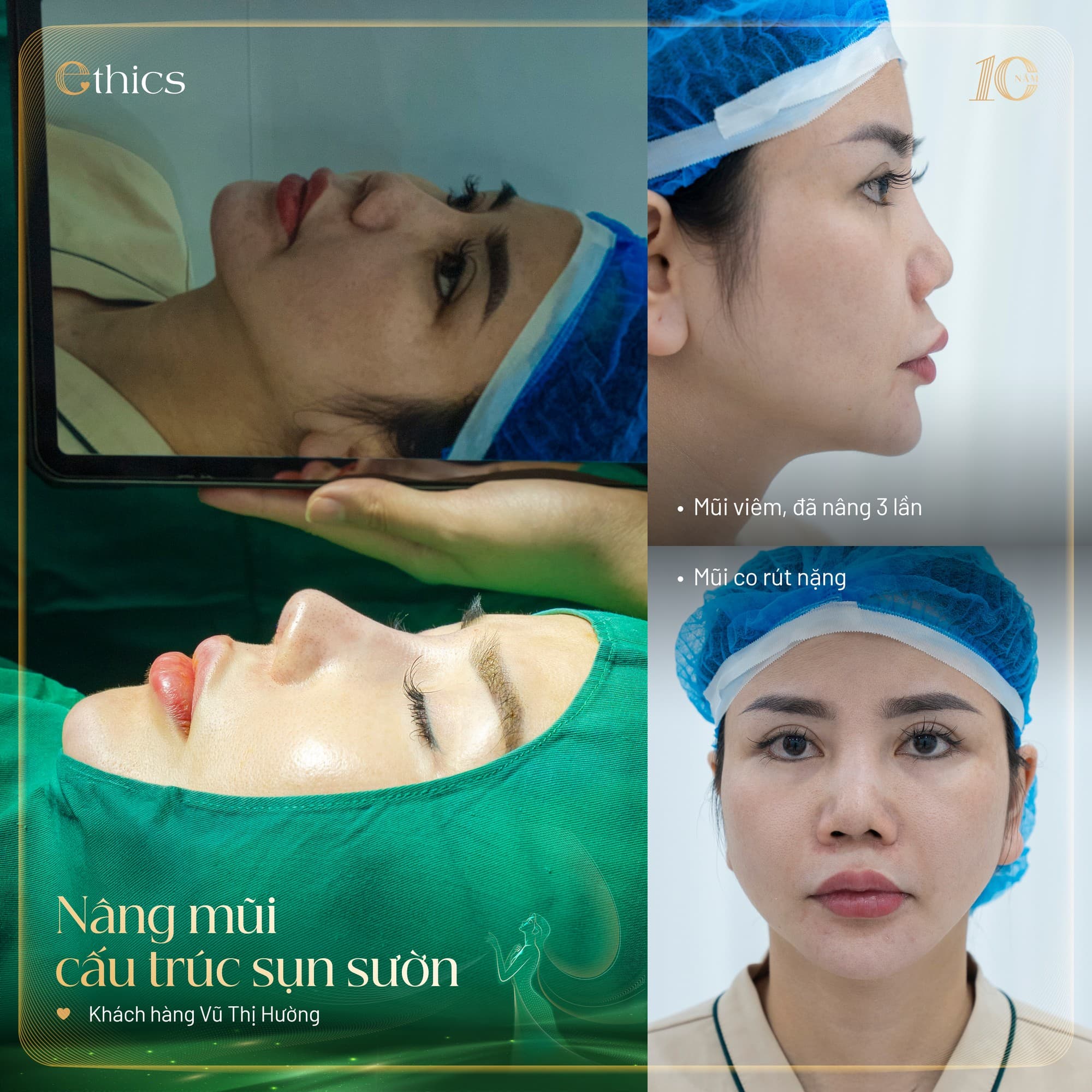 ການປິ່ນປົວດ້ວຍກະດູກຄ cartilage