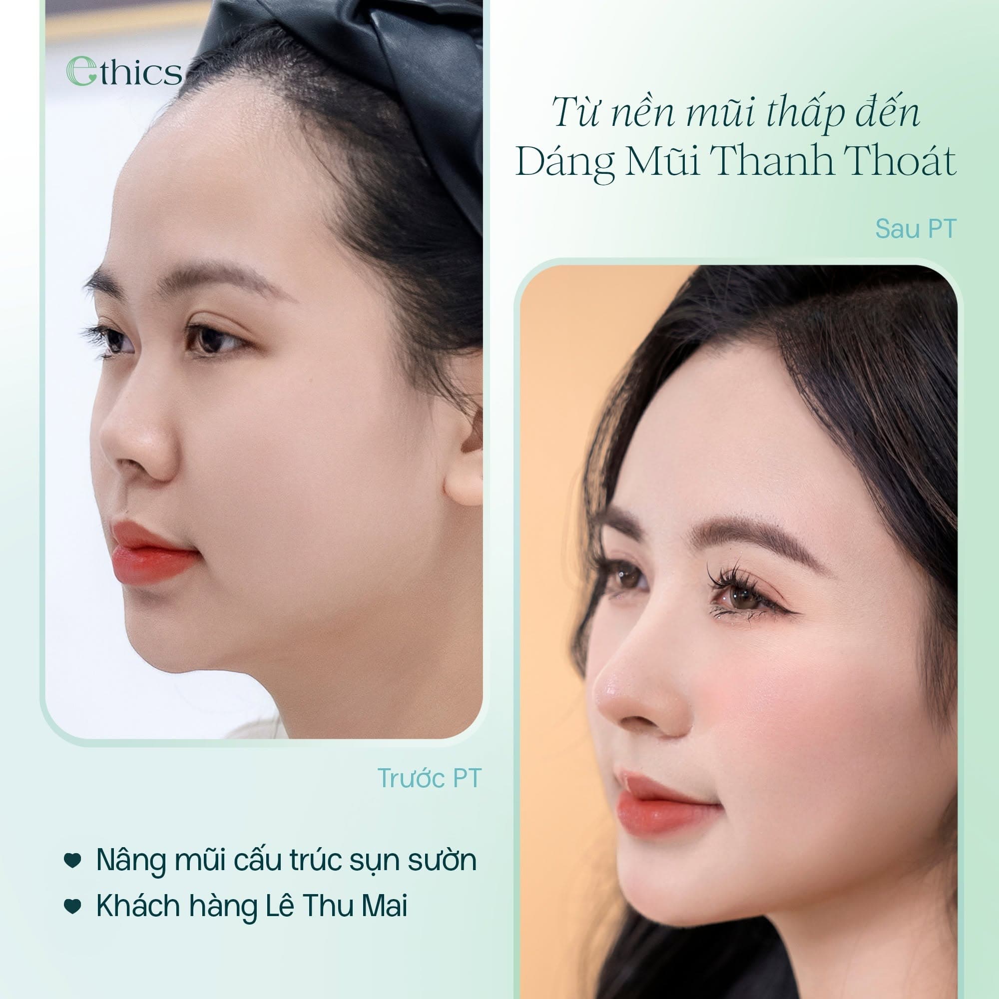 ວິທີການດູແລບໍລິເວນທີ່ເອົາກະດູກກະໂຕອອກຫຼັງຈາກຜ່າຕັດຖຽງດັງຢ່າງຖືກຕ້ອງແມ່ນແນວໃດ?