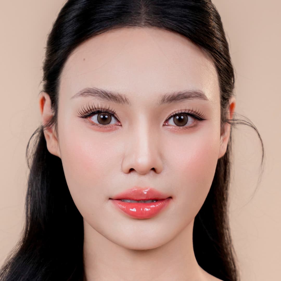 ລູກຄ້າ ລູຟູ໋ອງອານ - ຫຼັງຈາກຮັບການປິ່ນປົວປັບຮູບດັງຂອງ One Fit (ຮູບໃກ້ໆ)